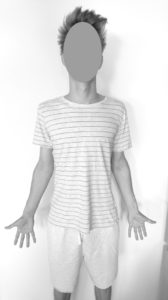 Pozycja opisu anatomicznego